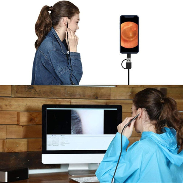 3 en 1 USB HD Digital Inspección Otoscopio Tipo Oído Endoscopio Digital Cera de Oído
